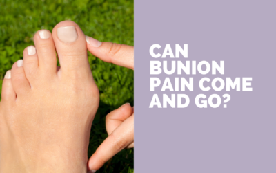 Can Bunion Pain Come and Go?