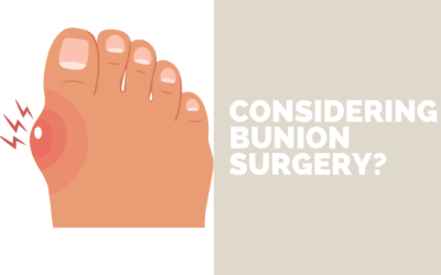 Considering Bunion Surgery?